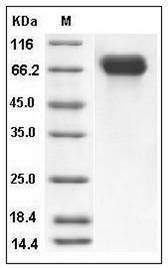 Influenza A H4N6 (A/mallard/Ohio/657/2002) Hemagglutinin / HA Protein (His Tag) SDS-PAGE