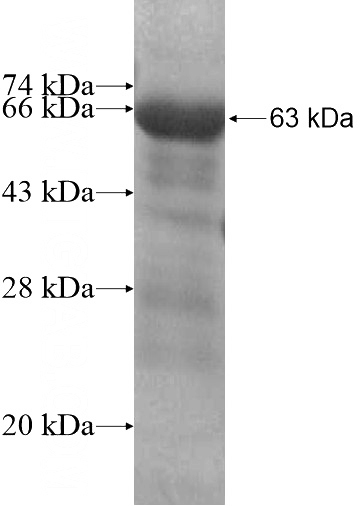 Recombinant Human ITGB1BP2 SDS-PAGE