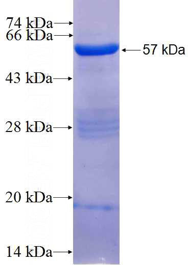 Recombinant Human STX5 SDS-PAGE