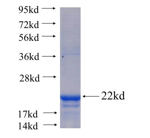 Recombinant human STIM2 SDS-PAGE