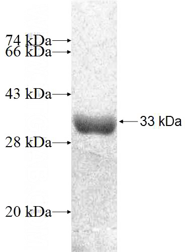 Recombinant Human CAPNS2 SDS-PAGE