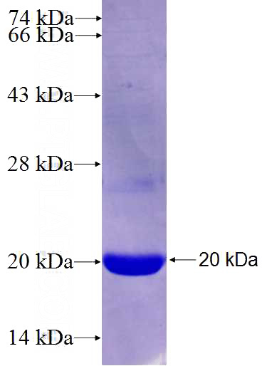 Recombinant Human PYCRL SDS-PAGE