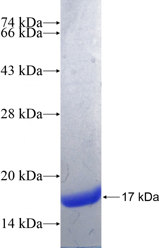 Recombinant Human RDRC SDS-PAGE
