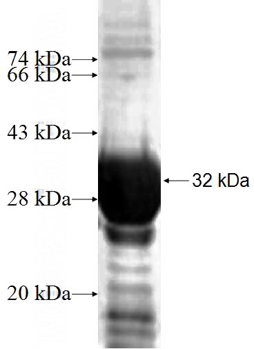 Recombinant Human MRPL9 SDS-PAGE