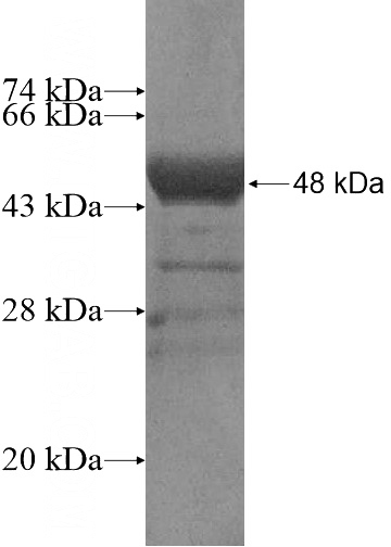 Recombinant Human LZTS1 SDS-PAGE