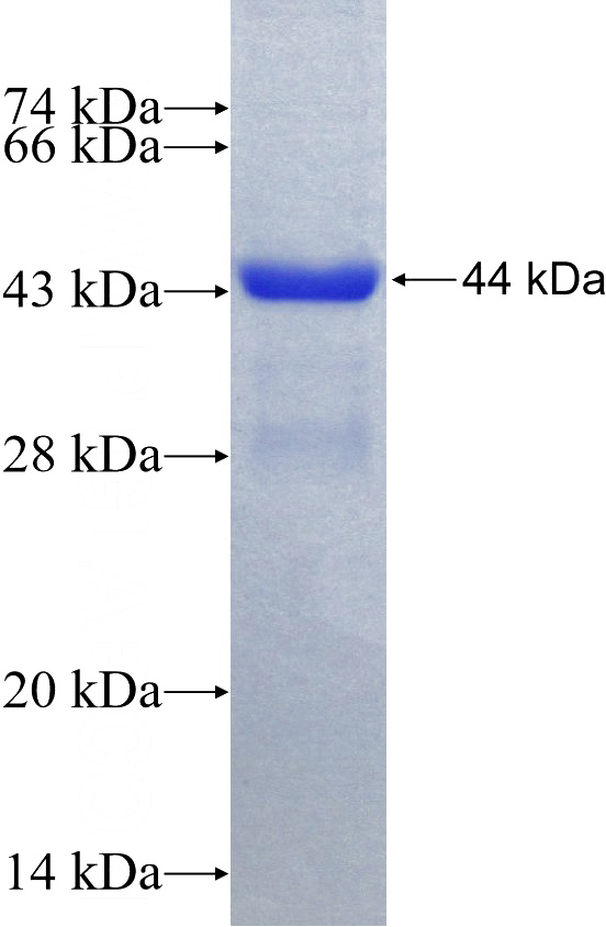 Recombinant Human NOX5 SDS-PAGE