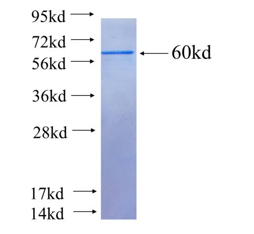 Human DKK3 Recombinant protein (GST tag)