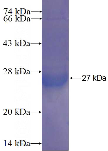 Recombinant Human ARL16 SDS-PAGE