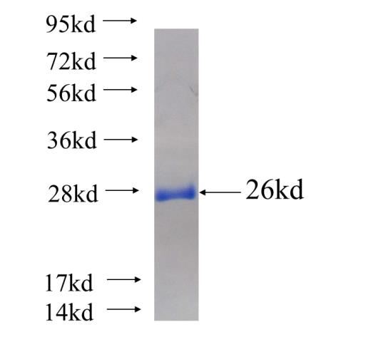 Recombinant human GTF2H3 SDS-PAGE