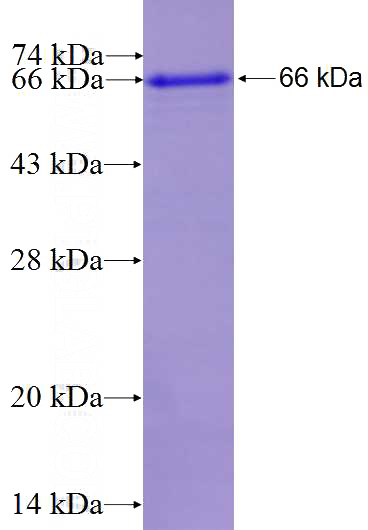 Recombinant Human CPT1A SDS-PAGE