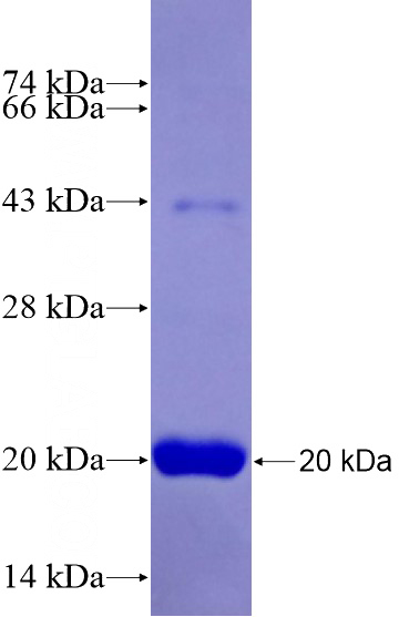 Recombinant Human KDM5B SDS-PAGE