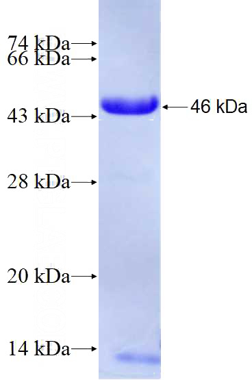 Recombinant Human DCLRE1C SDS-PAGE