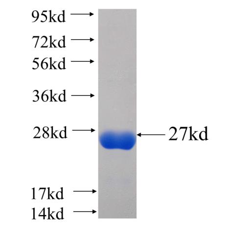 Recombinant human GINS2(Full length) SDS-PAGE