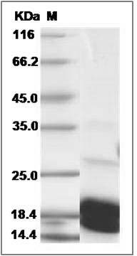 Human BCL2L11 / Bim Protein (His Tag) SDS-PAGE