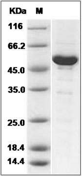 Human NAA10 / ARD1A Protein (His & GST Tag) SDS-PAGE