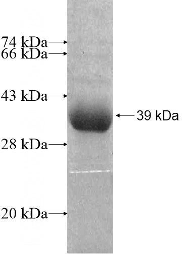 Recombinant Human ZNF41 SDS-PAGE