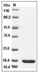 Human SETD8 / PR-Set7 Protein SDS-PAGE