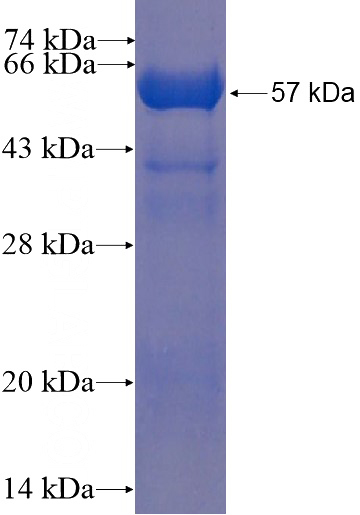 Recombinant Human KCTD10 SDS-PAGE