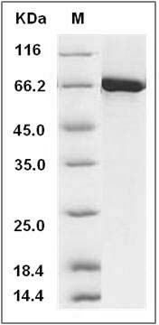 Human EphA4 / HEK8 Protein (aa 570-986, His & GST Tag) SDS-PAGE