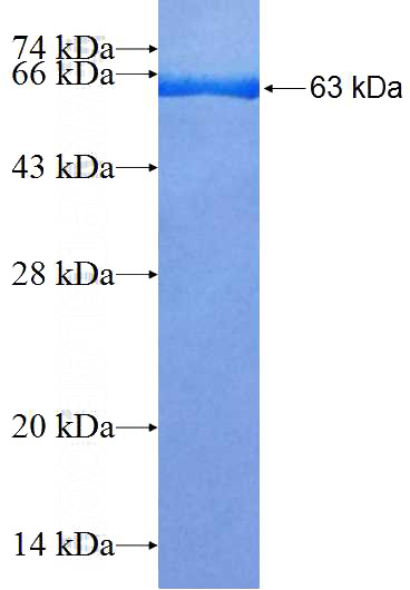 Recombinant Human EIF4G1 SDS-PAGE