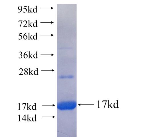 Recombinant human PGLYRP4 SDS-PAGE