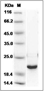 Human DUSP3 / VHR Protein SDS-PAGE