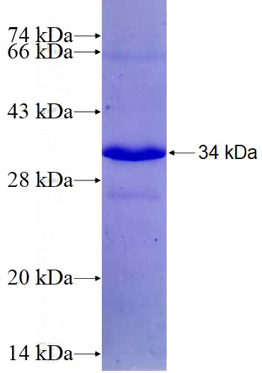Recombinant Human CCS SDS-PAGE
