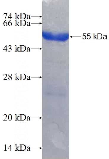 Recombinant Human EPAS1 SDS-PAGE
