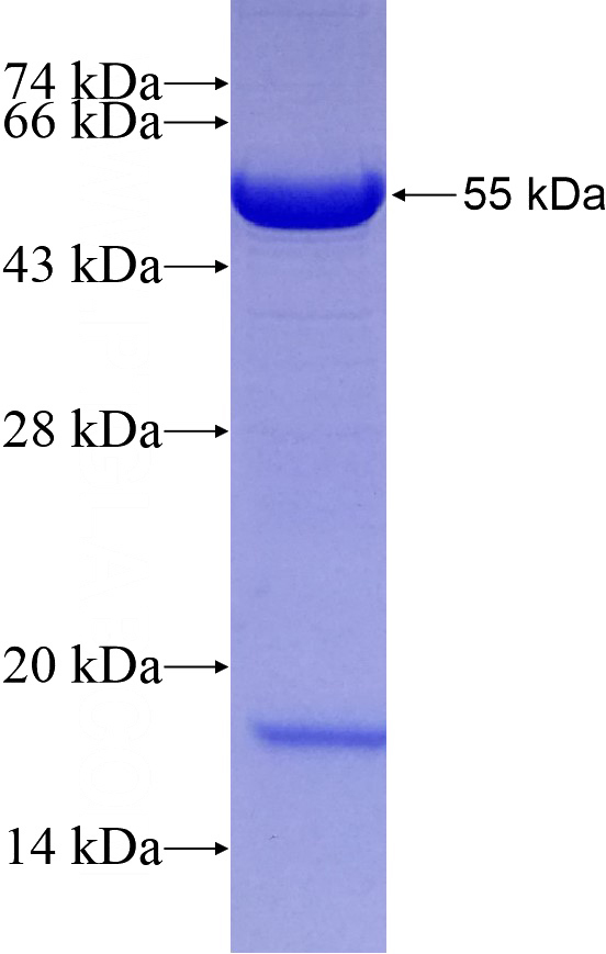 Recombinant Human GOLGA1 SDS-PAGE