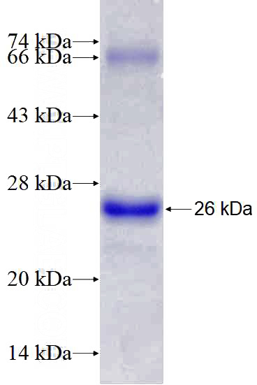 Recombinant Human RICTOR SDS-PAGE
