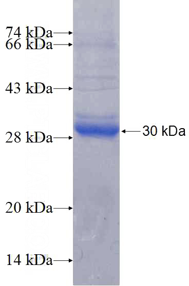 Recombinant Human RPS4Y1 SDS-PAGE