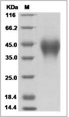 Rhesus B7-H5 / GI24 / VISTA Protein (His Tag)