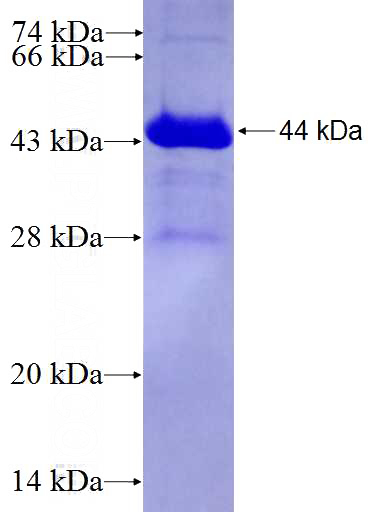 Recombinant Human SKP2 SDS-PAGE