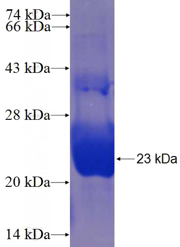 Recombinant Human CRB1 SDS-PAGE