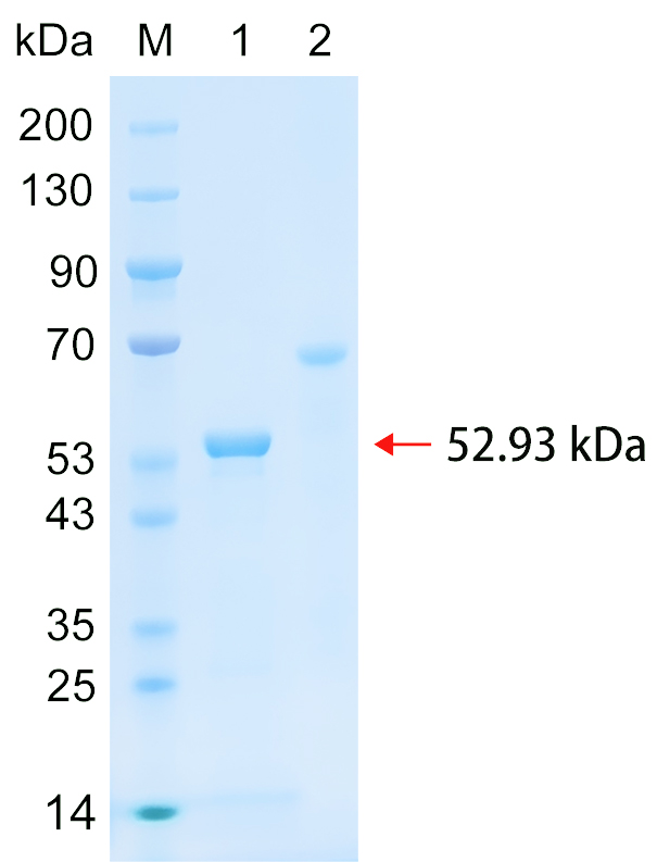 Recombinant LYN protein (His tag) SDS-PAGE