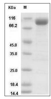 Human CD10 / Neprilysin / MME Protein (His Tag) SDS-PAGE