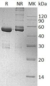 Human OTUB2/C14orf137/OTB2/OTU2 (GST tag) recombinant protein
