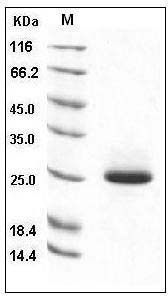 Mouse LCN2 / NGAL Protein (His Tag) SDS-PAGE