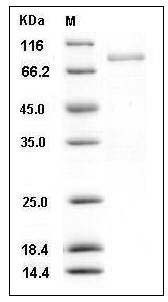 Human BLK / B Lymphocyte Kinase Protein (GST Tag) SDS-PAGE