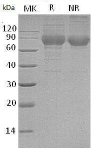Mouse Plxdc2/Tem7r (His tag) recombinant protein
