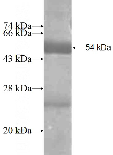 Recombinant Human GIMAP2 SDS-PAGE