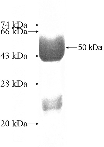 Recombinant Human RAB5B SDS-PAGE
