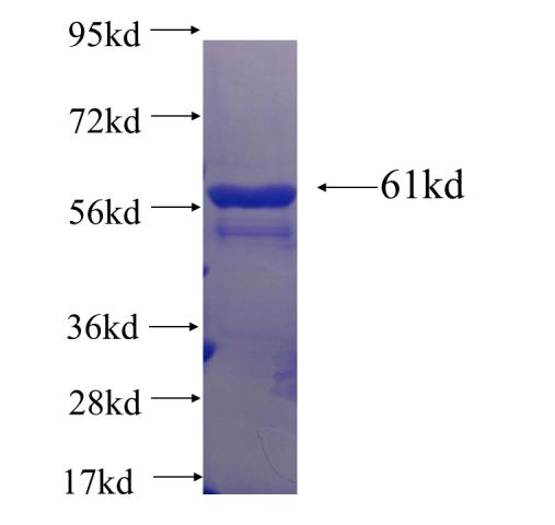 Recombinant human Musashi-2 SDS-PAGE