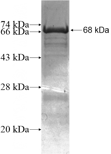 Recombinant Human ZNF276 SDS-PAGE