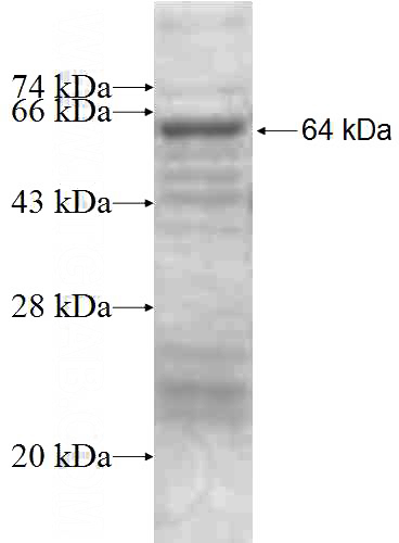 Recombinant Human MAP3K7IP2 SDS-PAGE