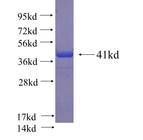 Recombinant human MRFAP1 SDS-PAGE