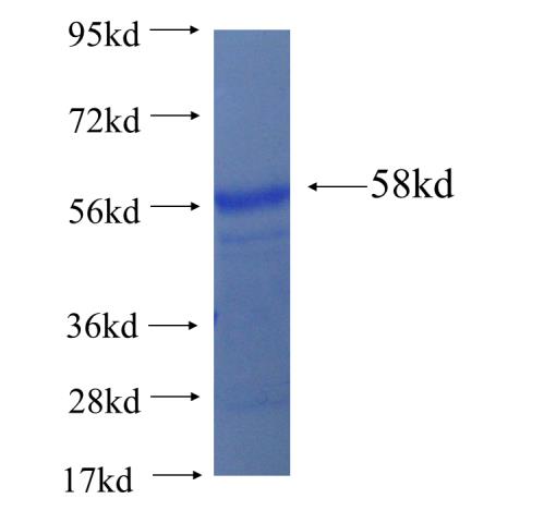 Recombinant human ZBTB48 SDS-PAGE