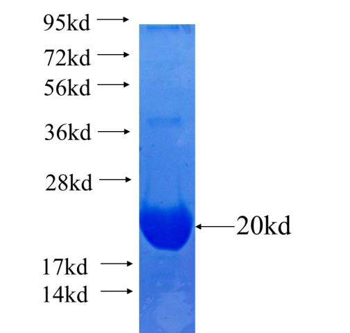Recombinant human RASGRF2 SDS-PAGE