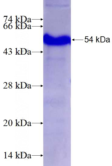 Recombinant Human CD248 SDS-PAGE