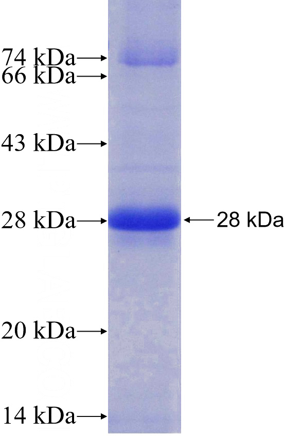 Recombinant Human AMFR SDS-PAGE
